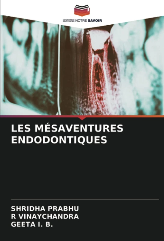 LES MÉSAVENTURES ENDODONTIQUES