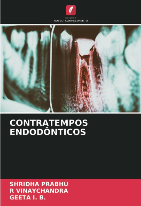CONTRATEMPOS ENDODÔNTICOS - Image 1