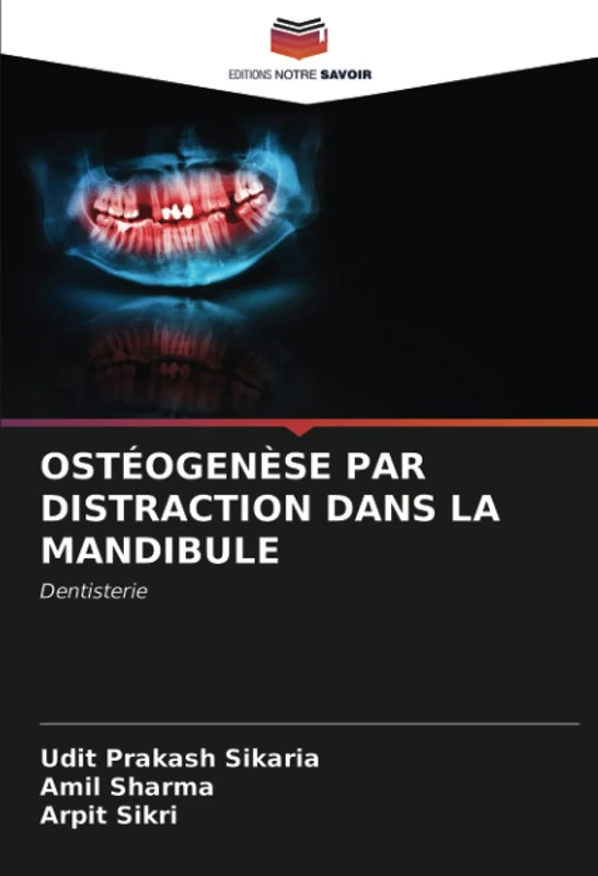 OSTÉOGENÈSE PAR DISTRACTION DANS LA MANDIBULE: Dentisterie
