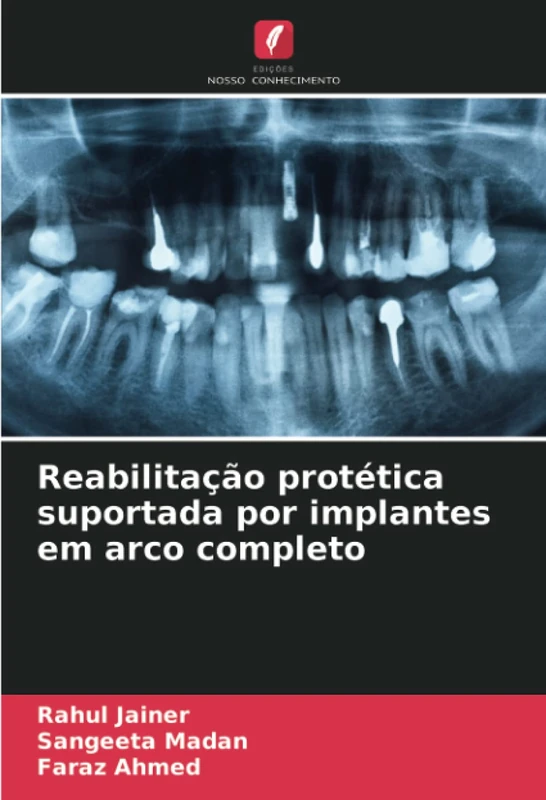 Reabilitação protética suportada por implantes em arco completo