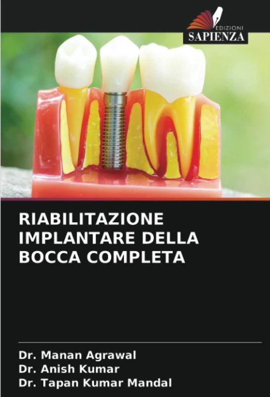 RIABILITAZIONE IMPLANTARE DELLA BOCCA COMPLETA
