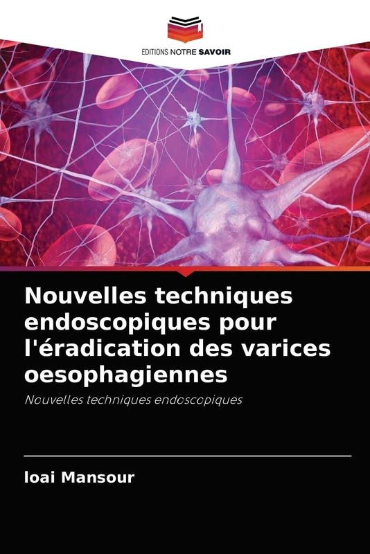 Nouvelles techniques endoscopiques pour l'éradication des varices oesophagiennes: Nouvelles techniques endoscopiques