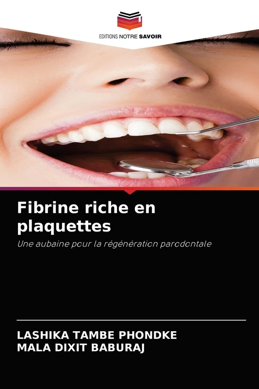 Fibrine riche en plaquettes: Une aubaine pour la régénération parodontale