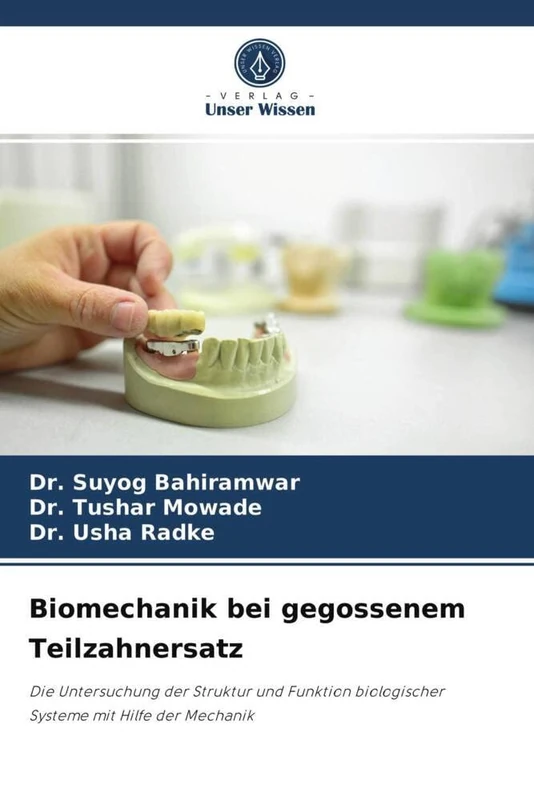 Biomechanik bei gegossenem Teilzahnersatz: Die Untersuchung der Struktur und Funktion biologischer Systeme mit Hilfe der Mechanik - Image 1