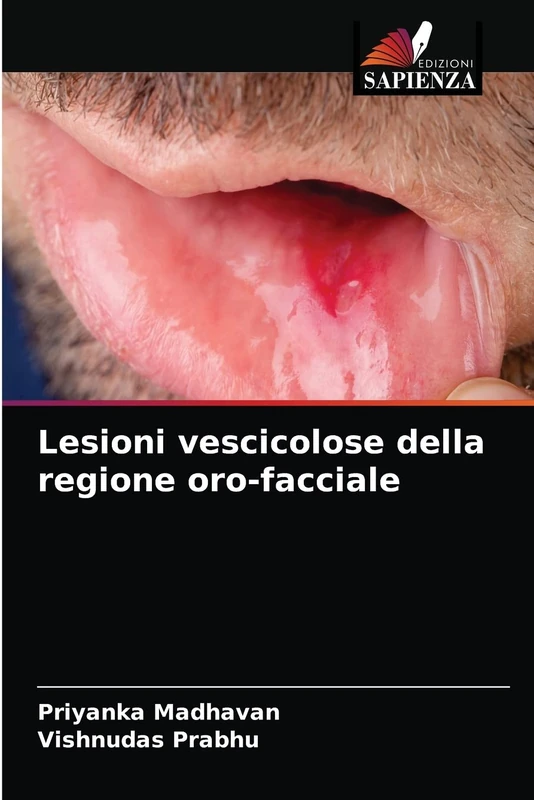 Lesioni vescicolose della regione oro-facciale - Image 1