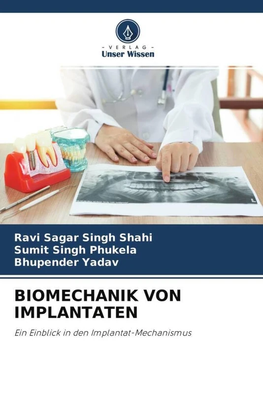 BIOMECHANIK VON IMPLANTATEN: Ein Einblick in den Implantat-Mechanismus - Image 1
