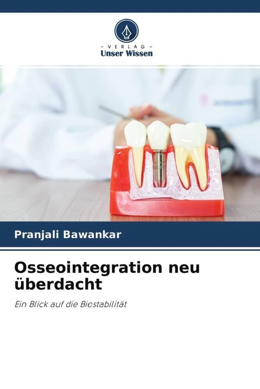 Osseointegration neu überdacht: Ein Blick auf die Biostabilität - Image 1