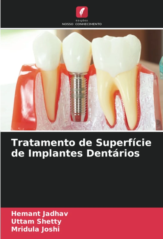 Tratamento de Superfície de Implantes Dentários