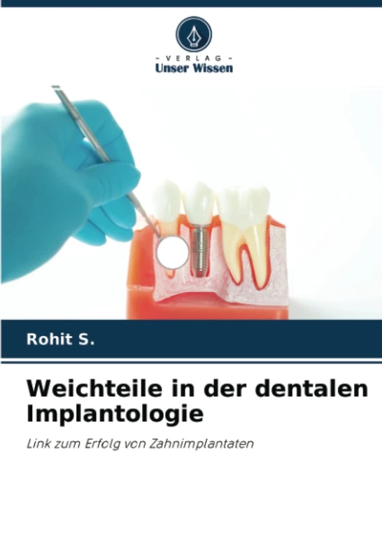 Weichteile in der dentalen Implantologie: Link zum Erfolg von Zahnimplantaten