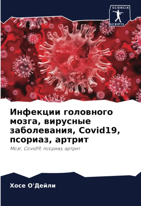 Инфекции головного мозга, вирусные заболевания, Covid19, псориаз, артрит: Мозг, Covid19, псориаз, артрит: Mozg, Covid19, psoriaz, artrit - Image 1