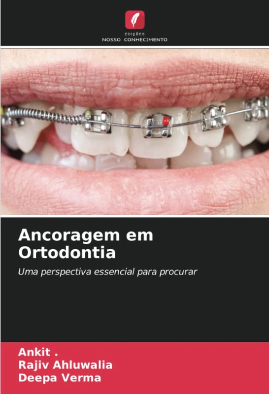 Ancoragem em Ortodontia: Uma perspectiva essencial para procurar - Image 1