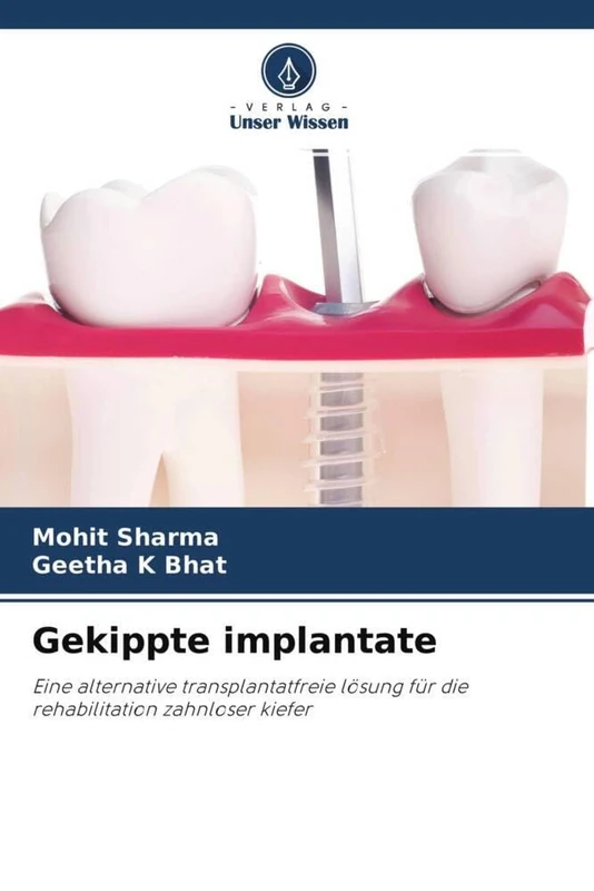 Gekippte implantate: Eine alternative transplantatfreie lösung für die rehabilitation zahnloser kiefer