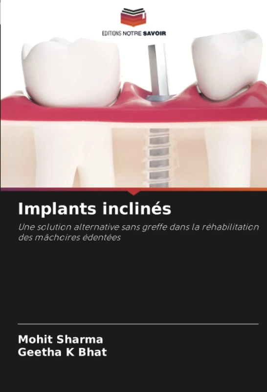 Implants inclinés: Une solution alternative sans greffe dans la réhabilitation des mâchoires édentées - Image 1