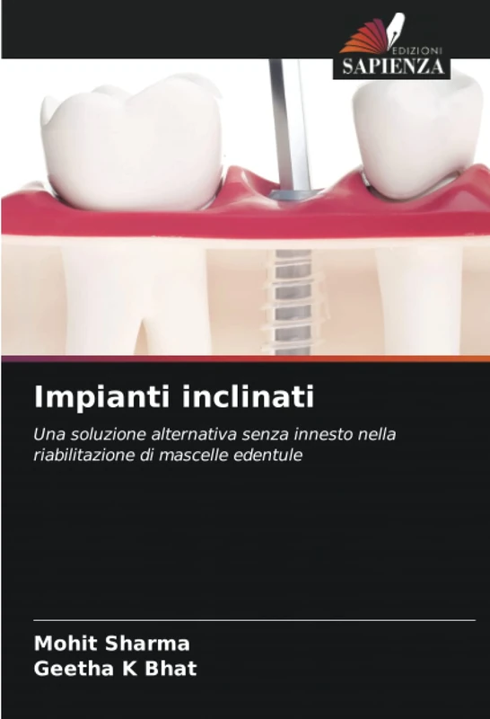 Impianti inclinati: Una soluzione alternativa senza innesto nella riabilitazione di mascelle edentule - Image 1