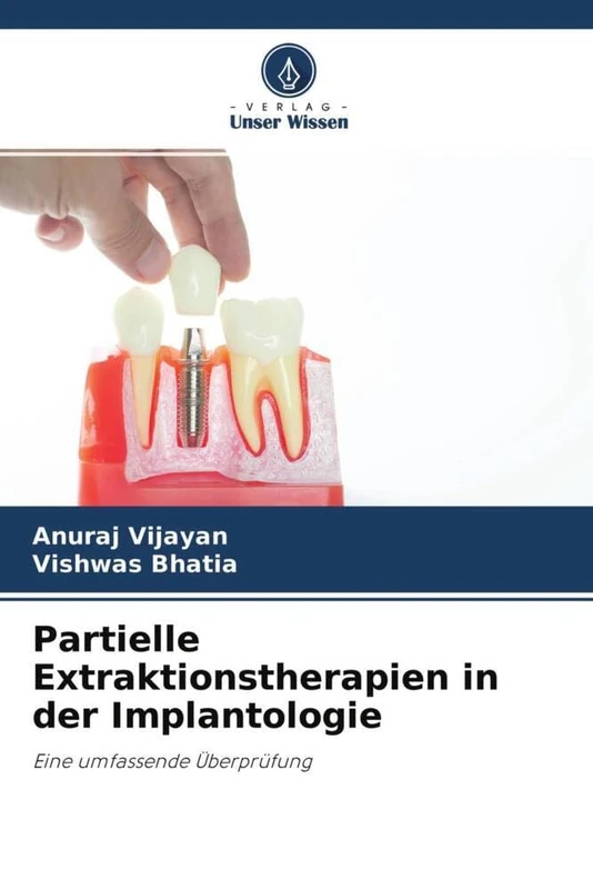 Partielle Extraktionstherapien in der Implantologie: Eine umfassende Überprüfung - Image 1