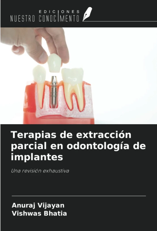 Terapias de extracción parcial en odontología de implantes: Una revisión exhaustiva - Image 1