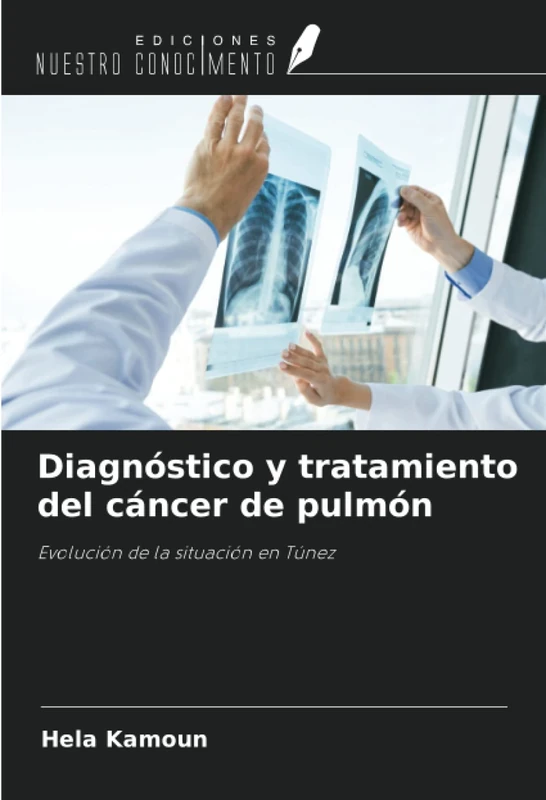 Diagnóstico y tratamiento del cáncer de pulmón: Evolución de la situación en Túnez