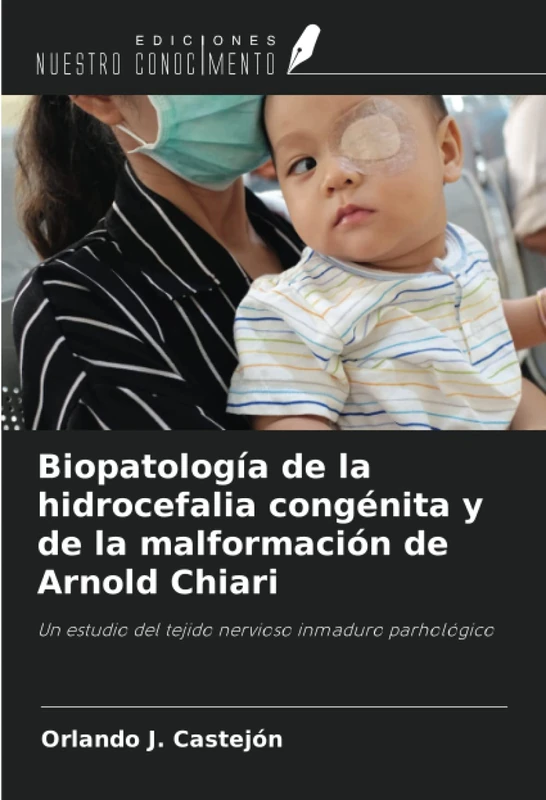 Biopatología de la hidrocefalia congénita y de la malformación de Arnold Chiari: Un estudio del tejido nervioso inmaduro parhológico