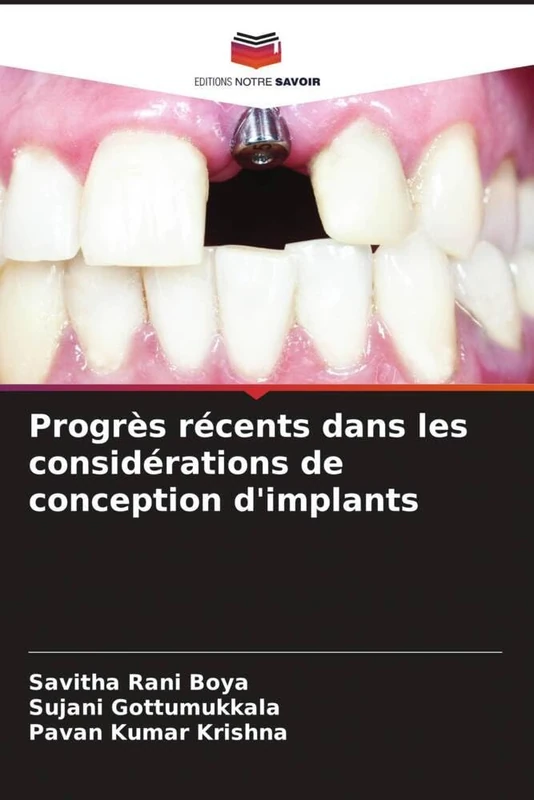 Progrès récents dans les considérations de conception d'implants