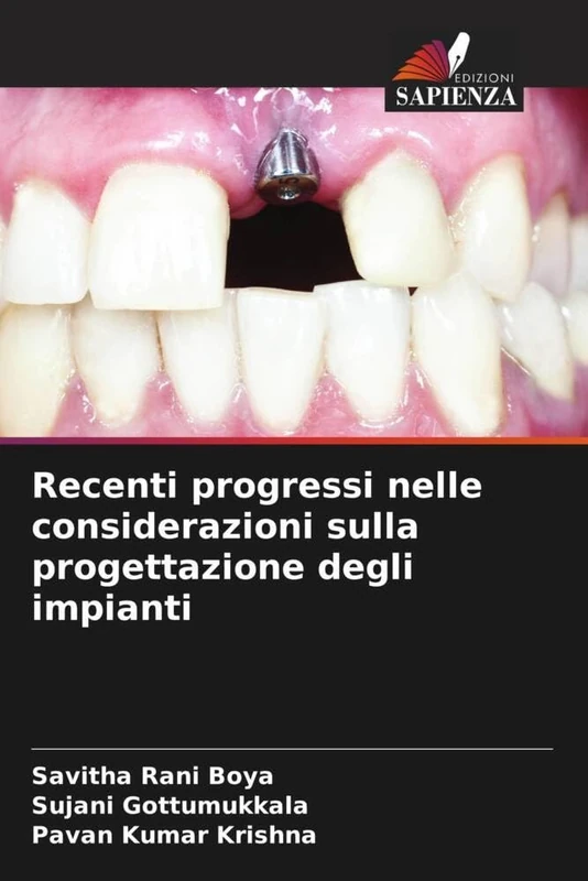 Recenti progressi nelle considerazioni sulla progettazione degli impianti