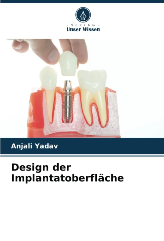 Design der Implantatoberfläche