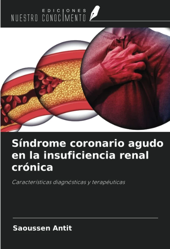 Síndrome coronario agudo en la insuficiencia renal crónica: Características diagnósticas y terapéuticas
