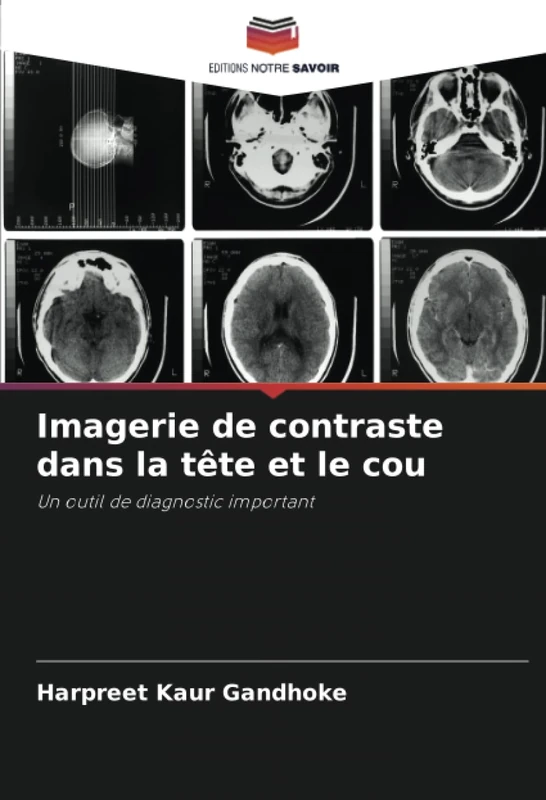 Imagerie de contraste dans la tête et le cou: Un outil de diagnostic important - Image 1
