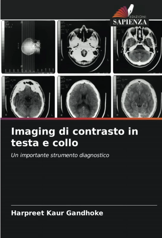 Imaging di contrasto in testa e collo: Un importante strumento diagnostico