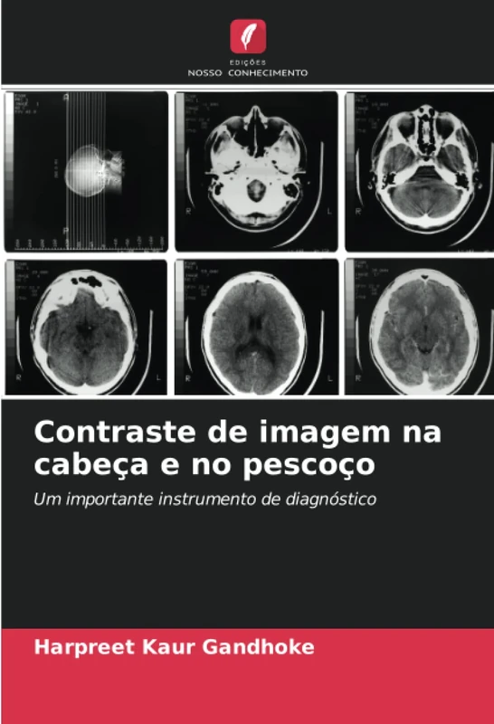 Contraste de imagem na cabeça e no pescoço: Um importante instrumento de diagnóstico
