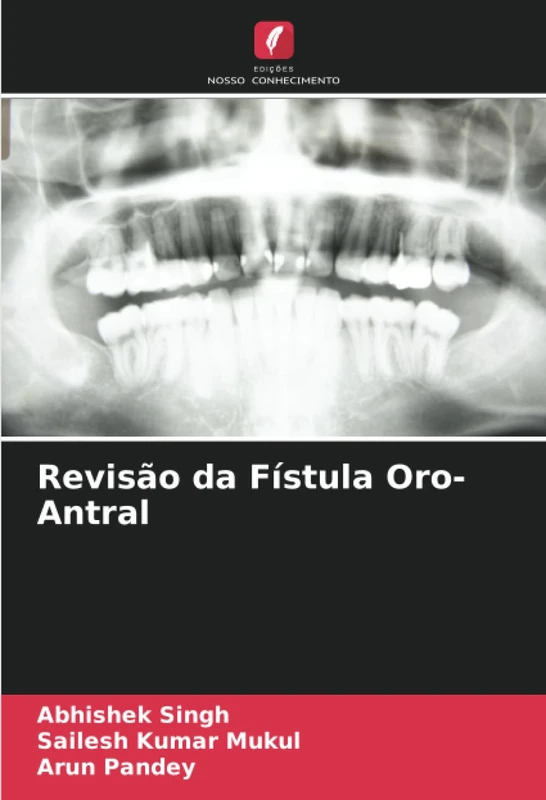 Revisão da Fístula Oro-Antral - Image 1