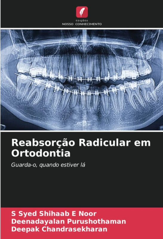 Reabsorção Radicular em Ortodontia: Guarda-o, quando estiver lá