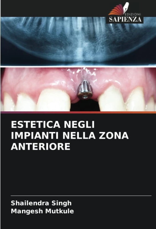 ESTETICA NEGLI IMPIANTI NELLA ZONA ANTERIORE