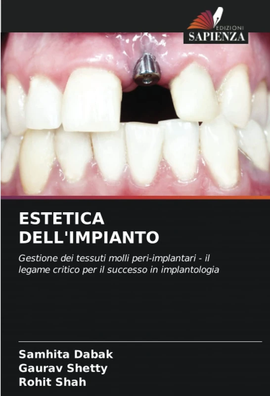 ESTETICA DELL'IMPIANTO: Gestione dei tessuti molli peri-implantari - il legame critico per il successo in implantologia