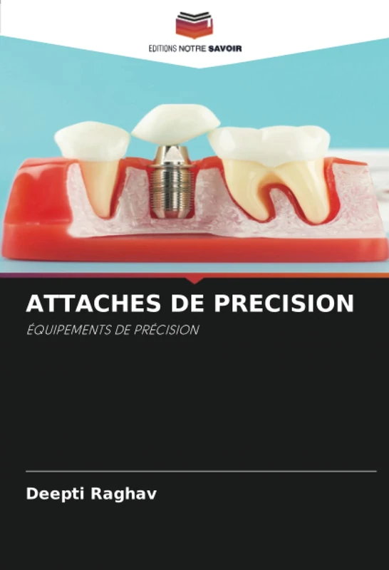 ATTACHES DE PRECISION: ÉQUIPEMENTS DE PRÉCISION