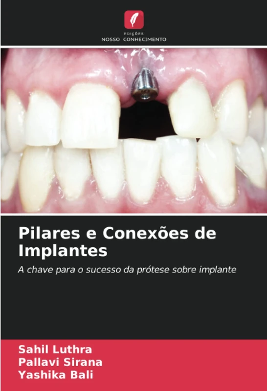 Pilares e Conexões de Implantes: A chave para o sucesso da prótese sobre implante - Image 1