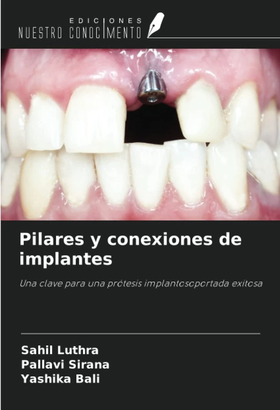 Pilares y conexiones de implantes: Una clave para una prótesis implantosoportada exitosa - Image 1
