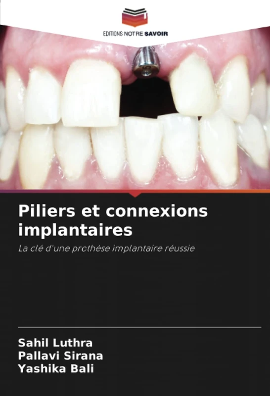 Piliers et connexions implantaires: La clé d'une prothèse implantaire réussie - Image 1