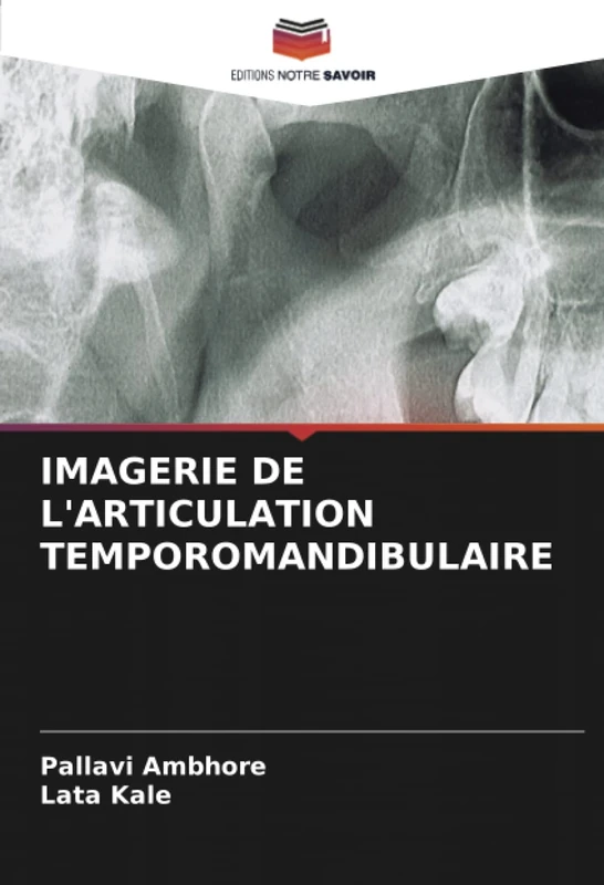IMAGERIE DE L'ARTICULATION TEMPOROMANDIBULAIRE