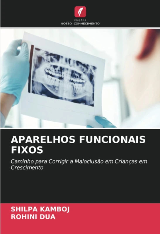 APARELHOS FUNCIONAIS FIXOS: Caminho para Corrigir a Maloclusão em Crianças em Crescimento - Image 1