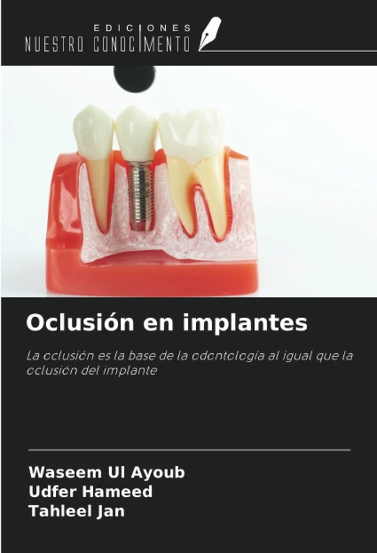 Oclusión en implantes: La oclusión es la base de la odontología al igual que la oclusión del implante