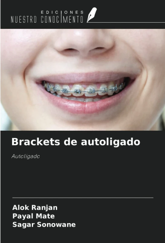 Brackets de autoligado: Autoligado