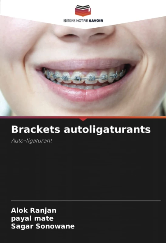 Brackets autoligaturants: Auto-ligaturant
