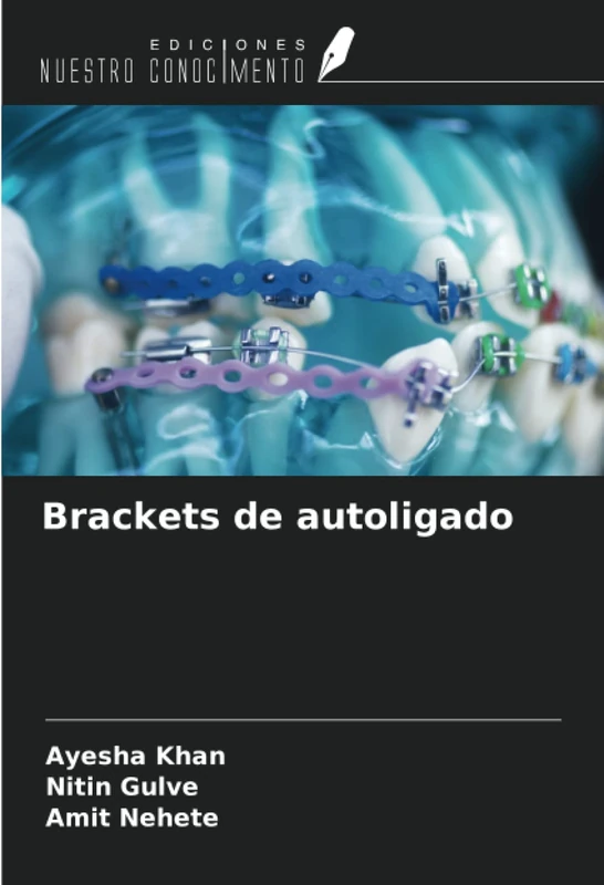 Brackets de autoligado