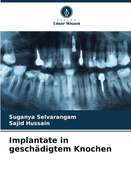 Implantate in geschädigtem Knochen
