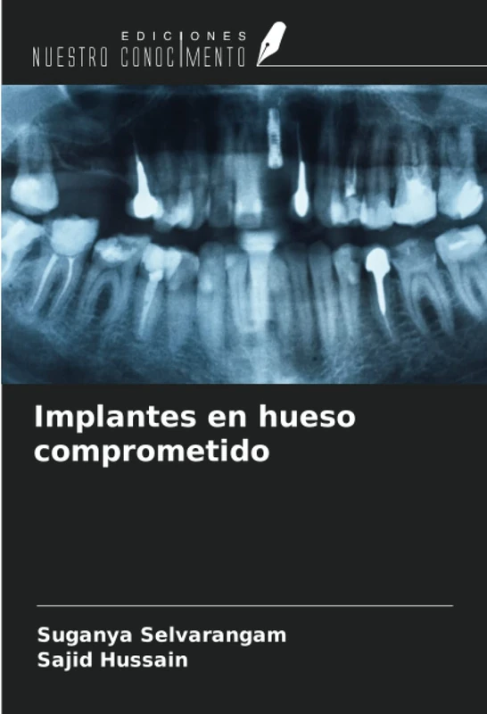 Implantes en hueso comprometido