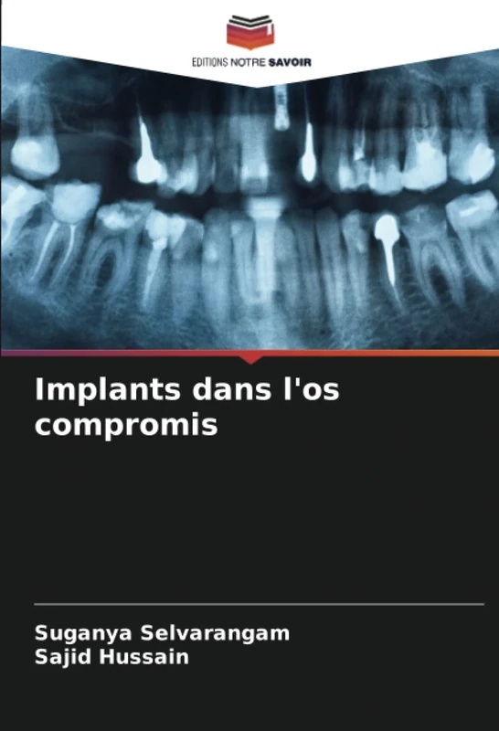 Implants dans l'os compromis