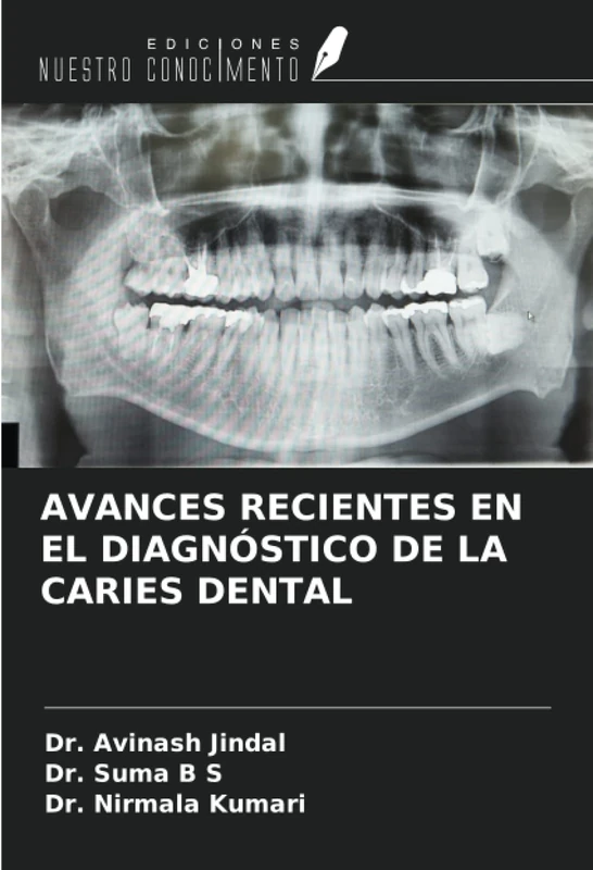 AVANCES RECIENTES EN EL DIAGNÓSTICO DE LA CARIES DENTAL - Image 1