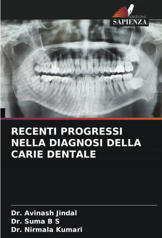 RECENTI PROGRESSI NELLA DIAGNOSI DELLA CARIE DENTALE