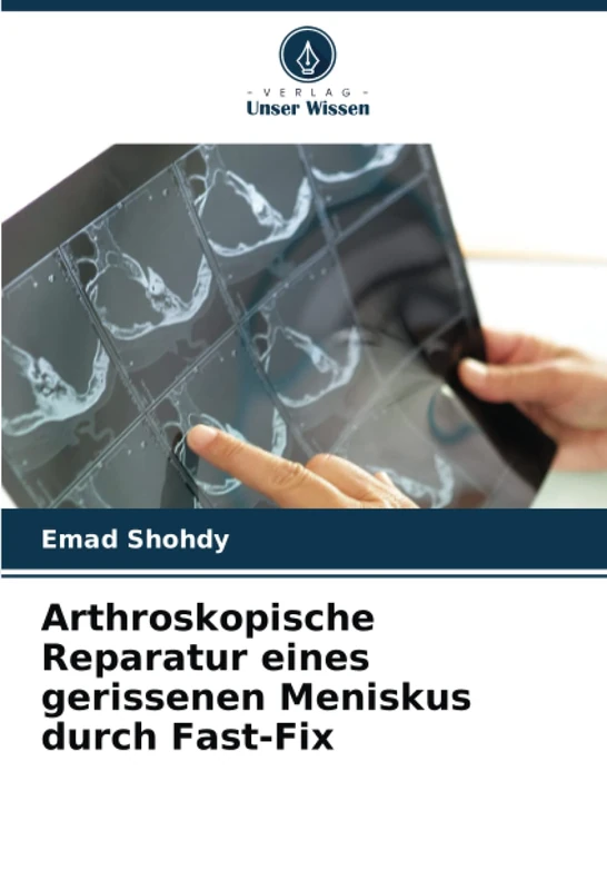 Arthroskopische Reparatur eines gerissenen Meniskus durch Fast-Fix - Image 1