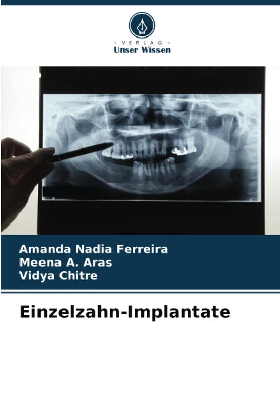 Einzelzahn-Implantate - Image 1